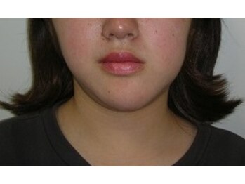 関西プロポーション小顔センター 大阪梅田院/顎エラ頬の歪みはお任せ下さい!