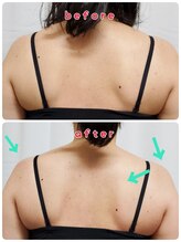 サンイチゼロ(310)/猫背矯正before→after