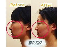 アジール 新潟市(agir)/Before/After画像