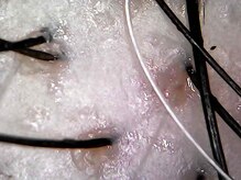 マジョラボ(Majo Labo.)/頭皮は育てる時代♪