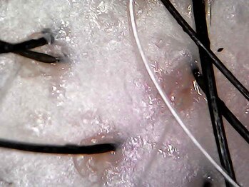 マジョラボ(Majo Labo.)/頭皮は育てる時代♪