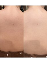 シノ 銀座(shino)/背中美人へ