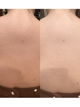 シノ 銀座(shino)/背中美人へ