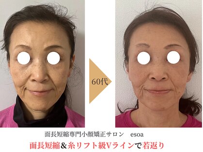 エソア(esoa)の写真