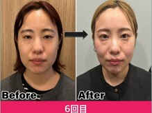 中野パーソナル整体院
