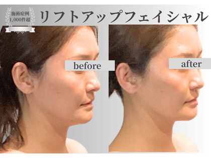 ノーブルノアール(Noble noir)の写真