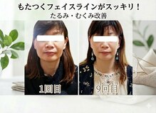 りんぱサロン まり