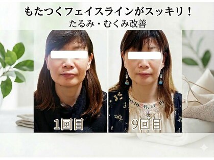 りんぱサロン まりの写真