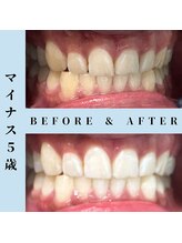 ドルチェ 水戸店(Dolce)/★ before → after ★