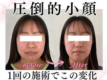 ジュピテール