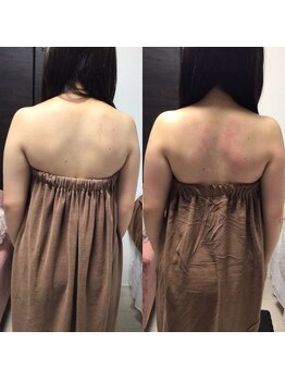 マイントゥー(mine too)/肩甲骨もくっきり♪