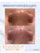 クレヴィー(Creviy)/New☆潤艶Wax脱毛(産毛脱毛)