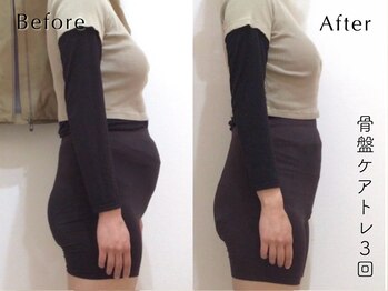 ペルビックハート(Pelvic Heart)/骨盤ケアトレ3回