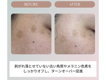 ノーブル(NOBLE)/ムートンホイップスパ大阪/野田