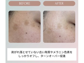 ノーブル(NOBLE)/ムートンホイップスパ大阪/野田