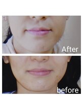 カノン(KANON)/グリーンピール