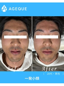 アジーク 町田店(AGEQUE)/20代男性の小顔もバッチリ