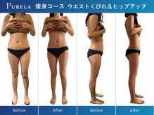 ピュアラ 心斎橋店/全身マシン痩身エンダモロジー