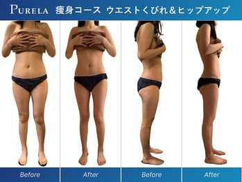 ピュアラ 心斎橋店/全身マシン痩身エンダモロジー