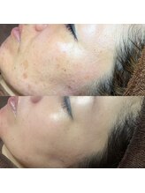 ホワラ 横浜店(Whila)/施術効果4