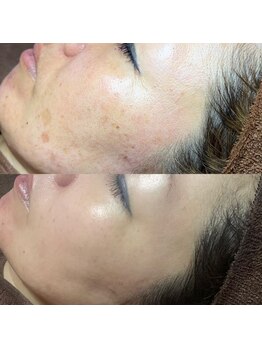 ホワラ 横浜店(Whila)/施術効果4