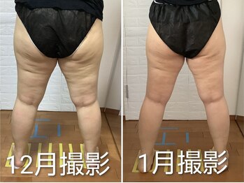 ビューティフルムーン(Beautiful Moon)/たった1カ月でこの細さに♪