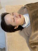 サロン ウェル(SALON WELL)/ 【ハーブピーリング　施術後】