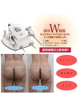 プレリー 自由が丘店/大人気セルゼロ