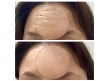 サロンミー(salon Mii)/