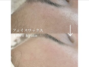 エステティック リベル キョウト 京都駅前店(Esthetic Liber Kyoto)/フェイスワックス脱毛