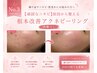 No.3【頑固なニキビ】原因から整える根本改善アクネピーリング(剥離なし)