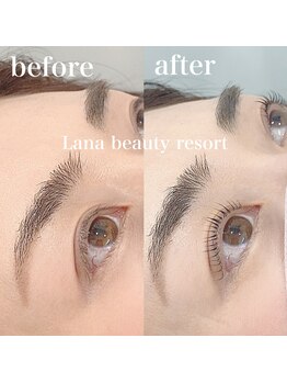 ラナビューティリゾート(Lana Beauty resort)/アップラッシュリフト