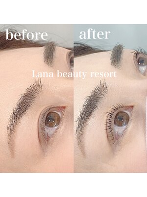 Lana Beauty resort