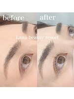 Lana Beauty resort