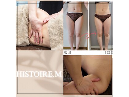 イストアールエム(HISTOIRE.M)の写真