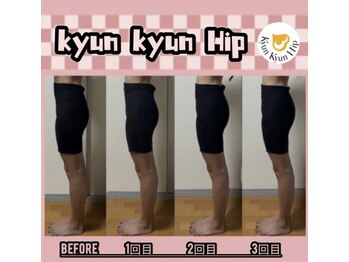 サロン ド ヴィーナス ビューティー(salon de Venus beaute)/ヒップアップ/浮腫み／美脚