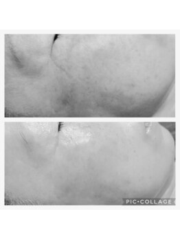 ルピナス(Lupinus.)/ビフォーアフター写真★