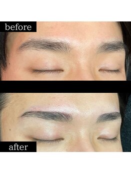 ユー 千葉駅前店(you)/症例写真