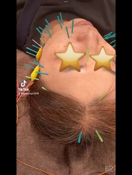 キヅキ鍼灸整体スタジオ(KIZUKI鍼灸整体スタジオ)/温活美容鍼