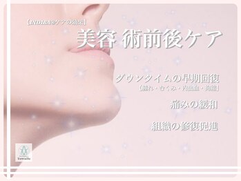 トワイル 沖縄/【術前術後ケア】インディバ