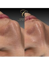 クレビア(CREBIA)/全メニュー毛穴洗浄付き！