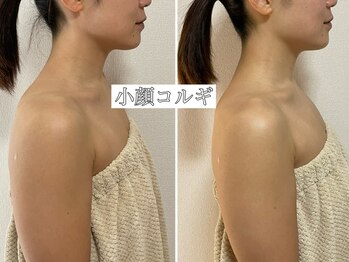 イデアルミー 大宮店(イデアルMe)/小顔コルギご利用のお客様