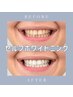 【メンズエステ】×【セルフホワイトニング】歯の黄ばみ/汚れ/5回¥16,500→