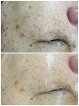 ルーメ(lume)/50代女性