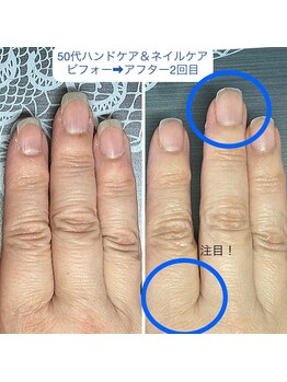 セルフではちょっと難しい四角