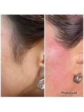 マイレ 銀座(MAILE)/もみあげ