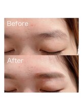 ビオラス(Biolus)/口コミ高評価の眉毛サロン！