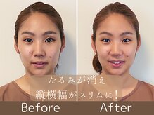 アントルーチェ 代々木上原(Entluce.)/めっちゃ小顔だね！って言われる