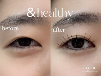 ミイン(miin)/アンドヘルシー