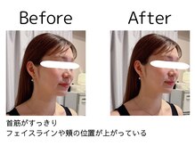 オリナ(olina)/-before & after-